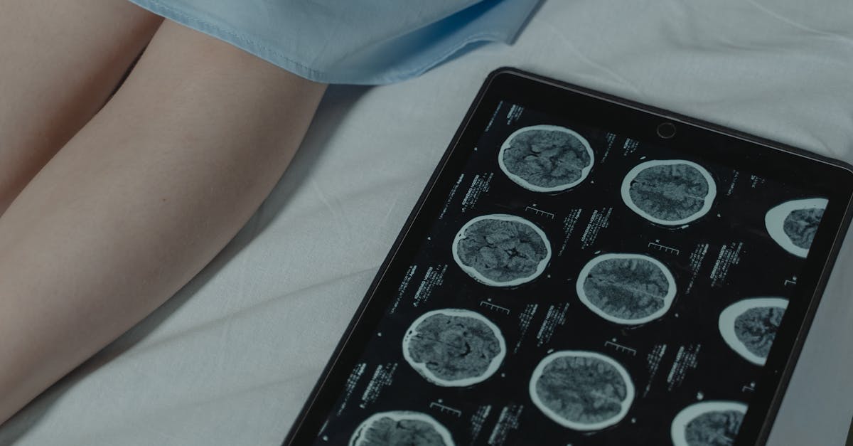 AI Medical Diagnosis Approaches Human Expertise