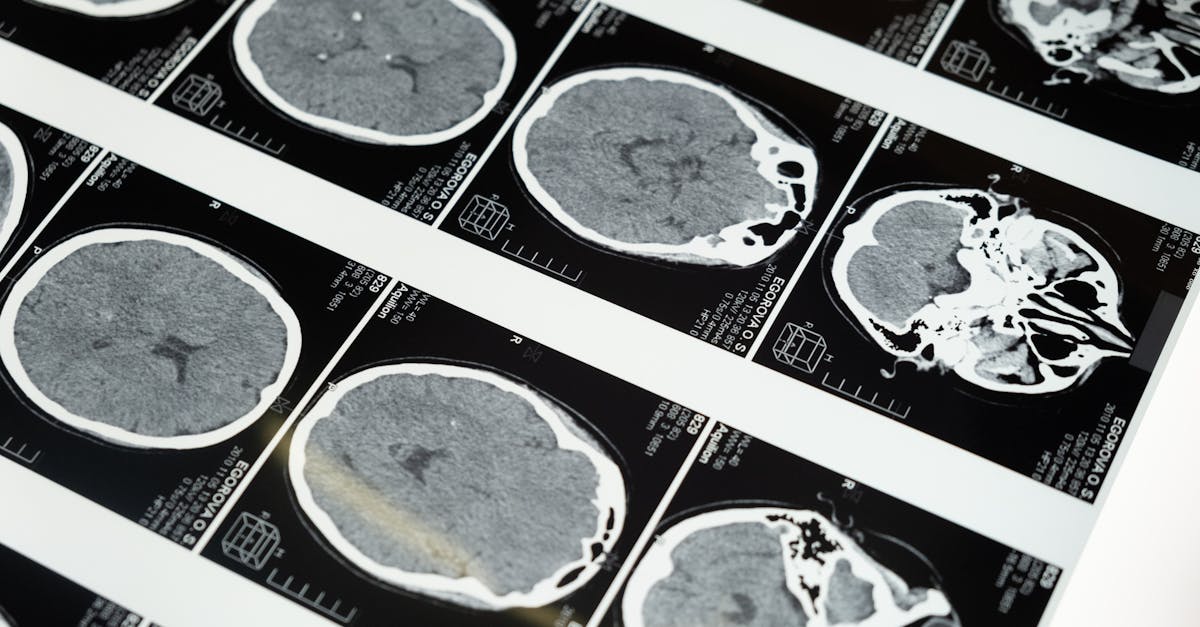 AI's Dopamine Connection