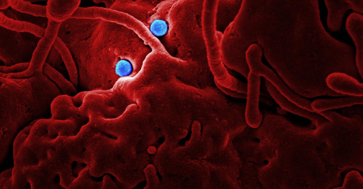 Ebola Outbreak Spreads in Congo and Uganda